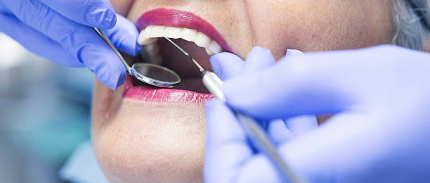 Best Emergency Dental Extractions in Summerlin South, NV